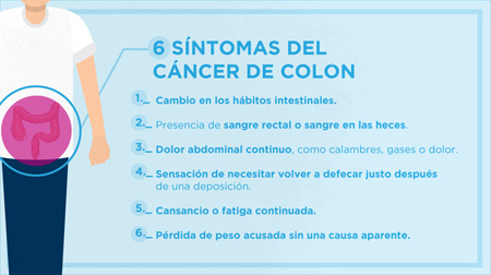 Cancerul de colon: Factori de Risc, Simptome & Tratament, Cancer de colon ultima etapa