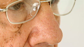 geriatricarea salud ocular