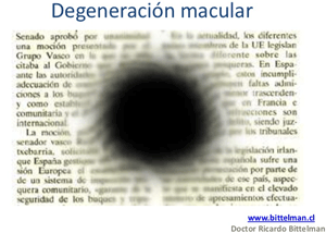 Geriatricarea degeneración macular