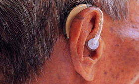 Geriatricarea audición deterioro cognitivo
