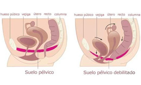 Geriatricarea suelo pélvico Femintimate menopausia