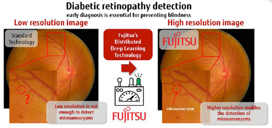 geriatricarea Fujitsu retinopatía diabética Inteligencia Artificial