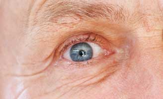 geriatricarea retina Alzheimer