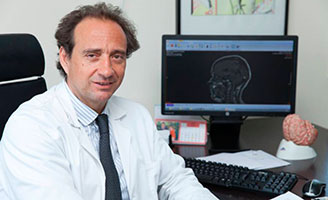 geriatricarea prevención del Alzheimer