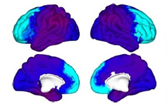 geriatricarea alzheimer