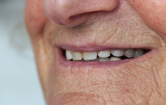 geriatricarea pérdida de dientes